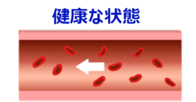 血管の健康な状態