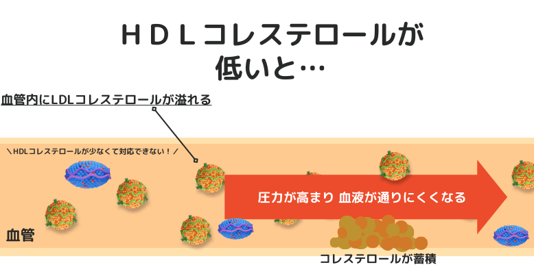 HDLコレステロールが低いと、LDLコレステロールが体内に残ったままの状態になる