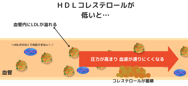 HDLが低いと血管の掃除機能が弱く、心血管系リスクとなる