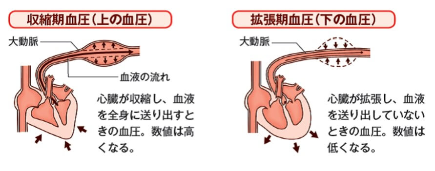 食塩の過剰摂取が高血圧の原因になる仕組み
