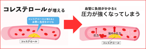 血圧上昇の原因