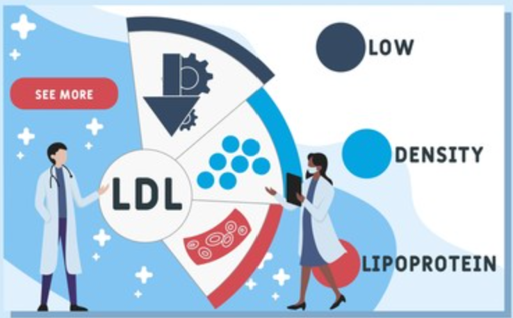 LDLが担う役割