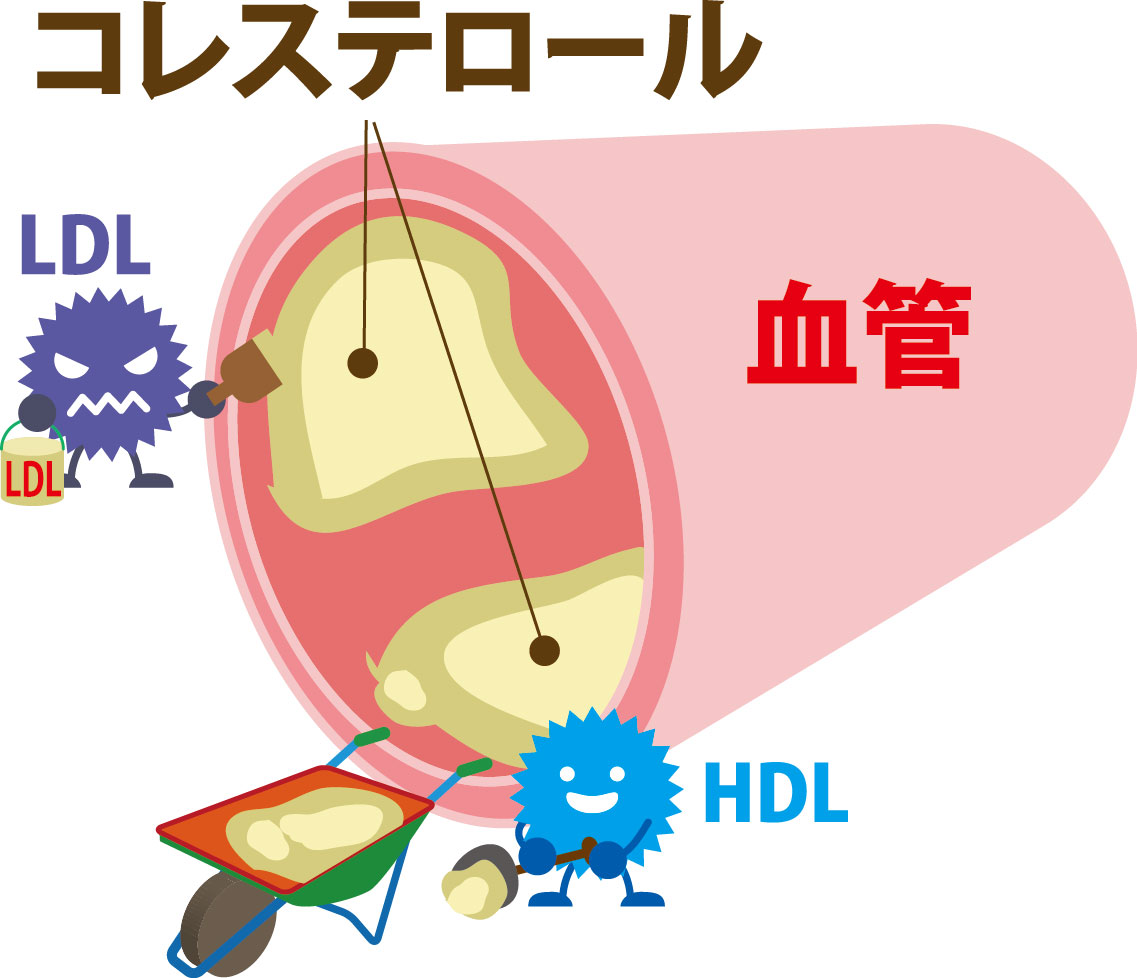 過剰なLDLが体に悪影響を及ぼす